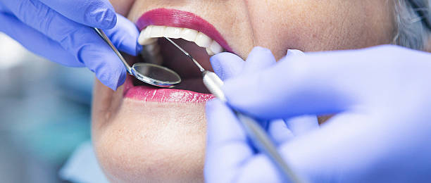 Best Same-Day Emergency Dentist in Point Venture, TX